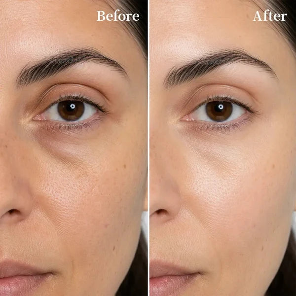 Beautyturess Caffeine & PDRN Collagen Moisturizing Eye Patches (80g/60 patches)